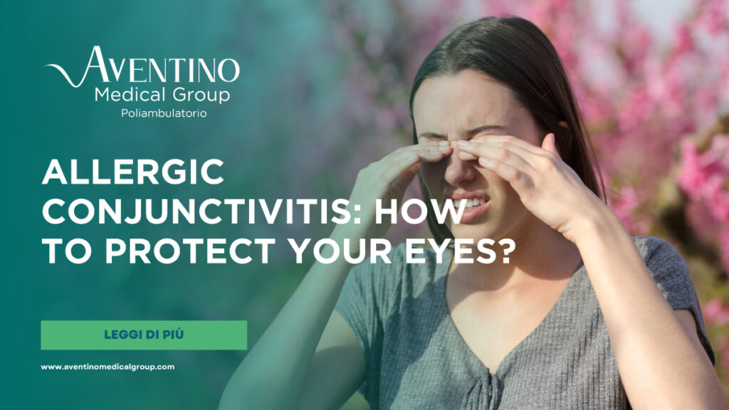 Allergic conjunctivitis