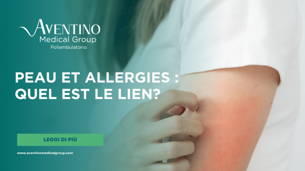 Peau et allergies