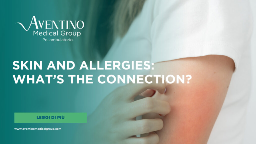 Skin and allergies